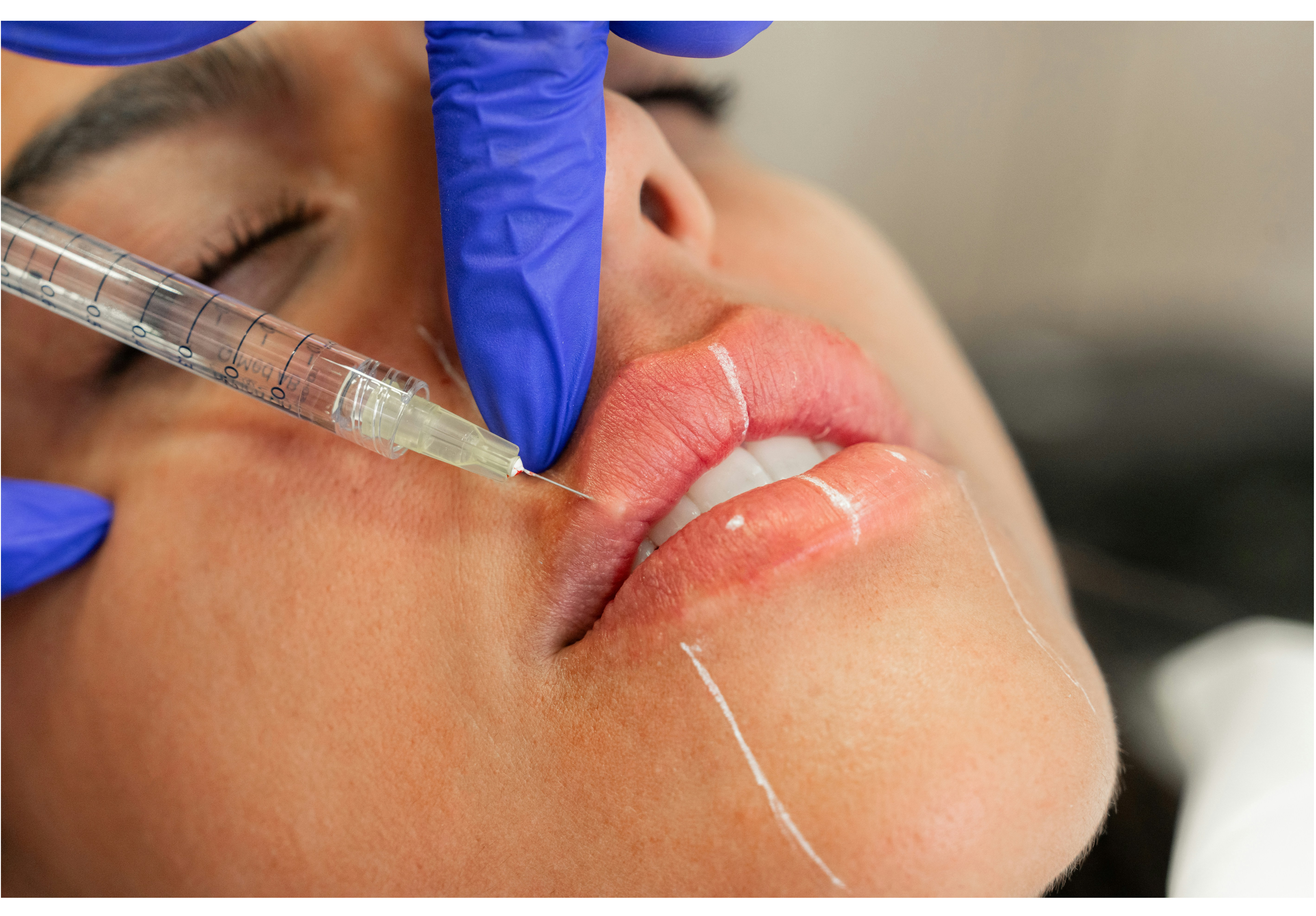 map[src:images/filler.png]